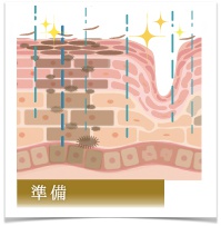 準備（コンディショニングケア）